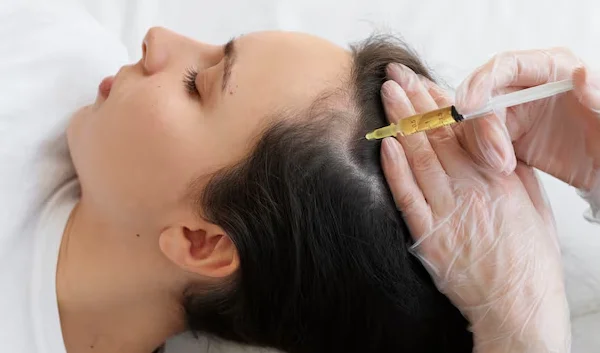 PRP Therapy