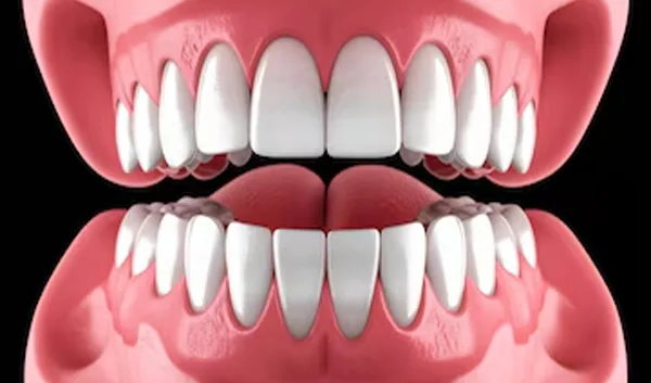 Management Of White Patches Or Oral Cavity